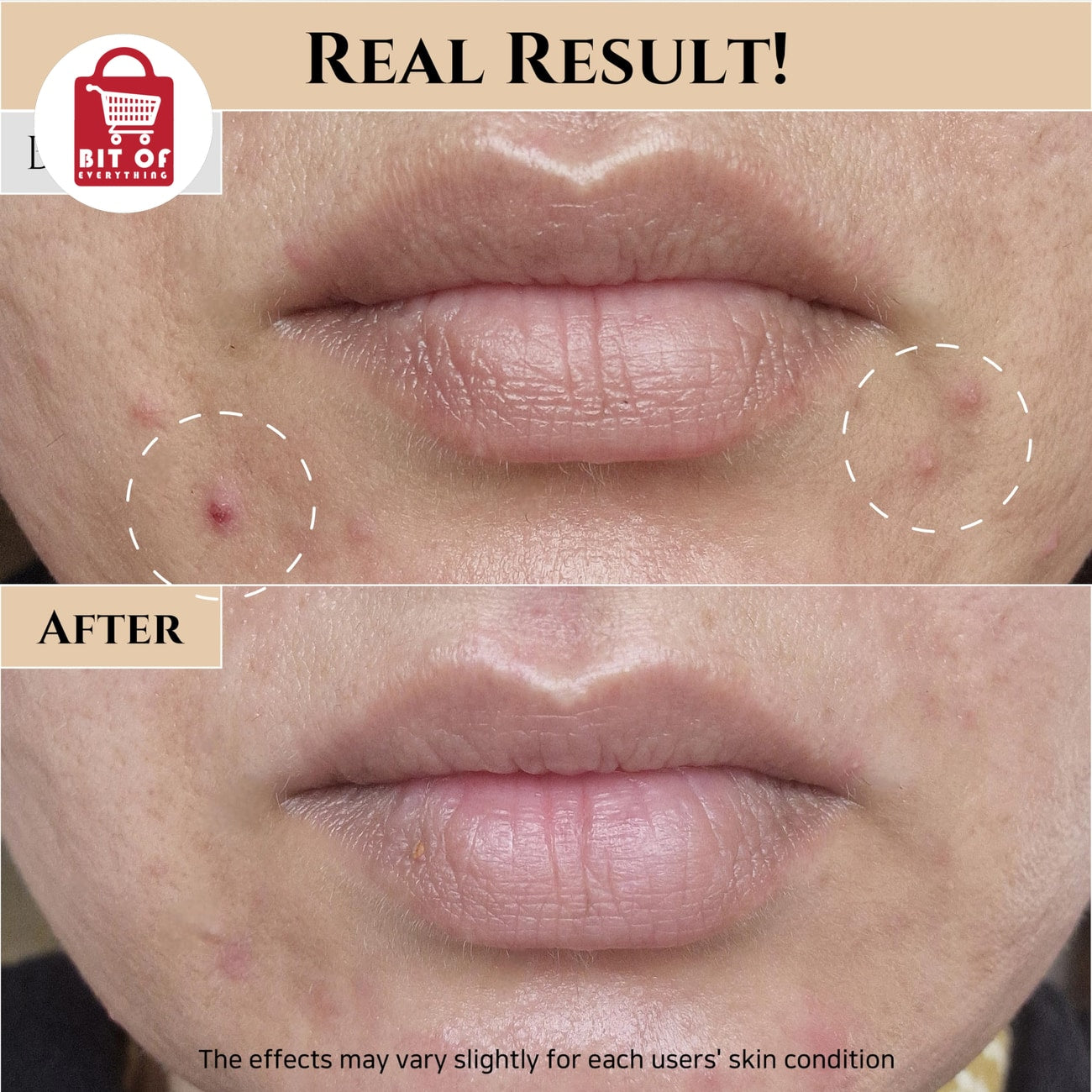 Korean Glow Toner – Deep Moisturizing, Acne & Pore Care for Oily and Combination Skin