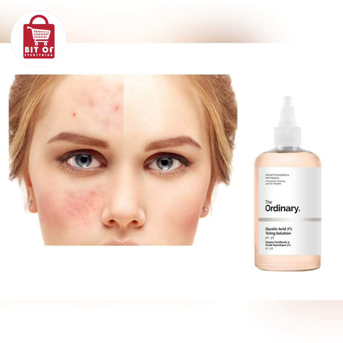 The Ordinary Glycolic Acid Toner – Exfoliating Facial Toner for Smoother, Brighter & More Refined-Looking Skin